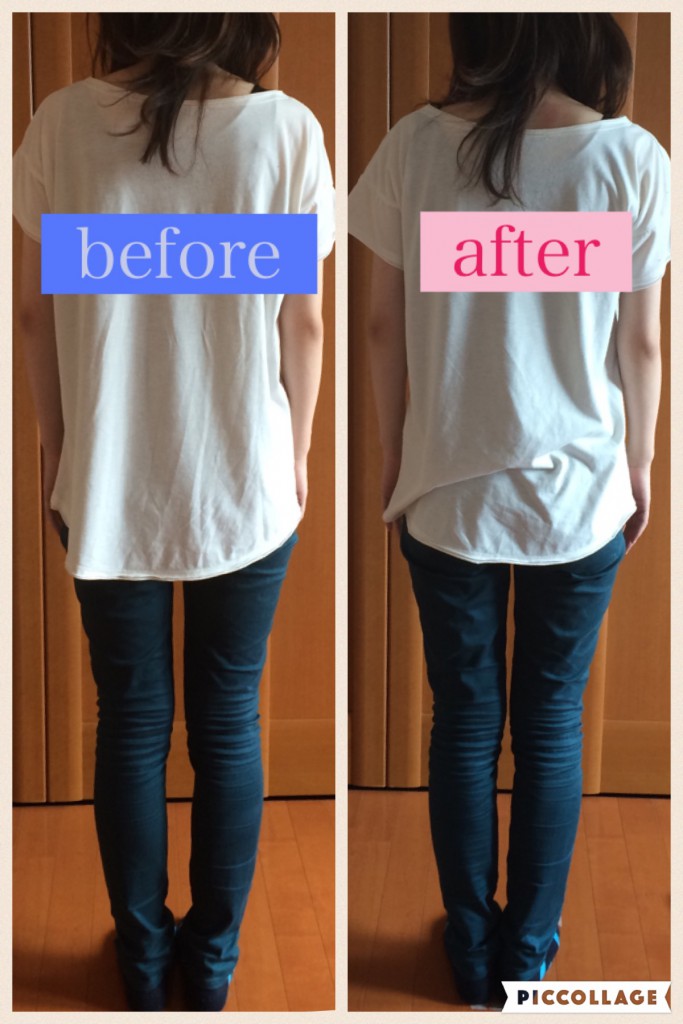 産後2ヶ月のママ?締まり過ぎていた骨盤が柔らかく、むくみもなくなりました(^O^)骨盤リペアレッスン✨